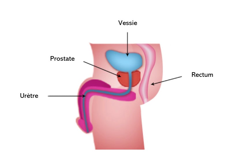 drainage prostate gland urinez noaptea in pat